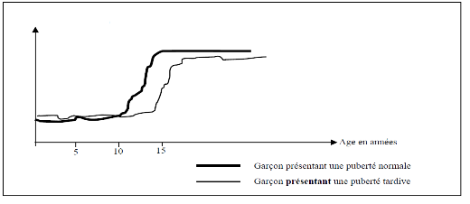 Puberte retardee